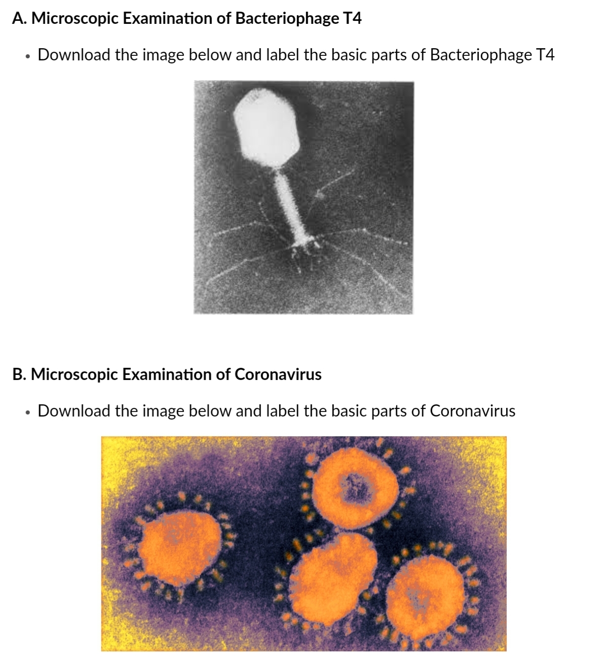 A. Microscopic Examination of Bacteriophage T4
Download the image below and label the basic parts of Bacteriophage T4
B. Microscopic Examination of Coronavirus
Download the image below and label the basic parts of Coronavirus
