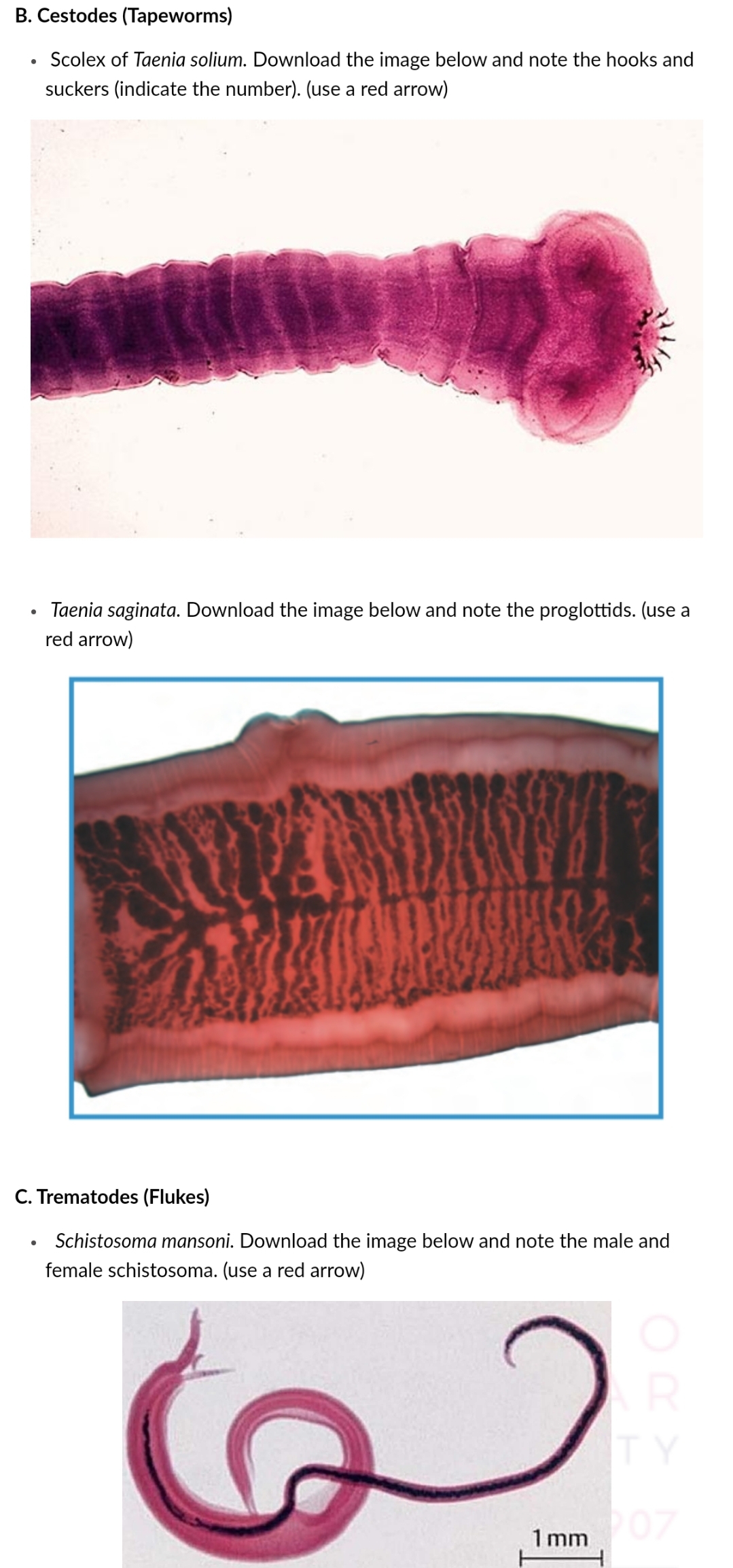 B. Cestodes (Tapeworms)
Scolex of Taenia solium. Download the image below and note the hooks and
suckers (indicate the number). (use a red arrow)
Taenia saginata. Download the image below and note the proglottids. (use a
red arrow)
C. Trematodes (Flukes)
Schistosoma mansoni. Download the image below and note the male and
female schistosoma. (use a red arrow)
TY
1 mm 07
