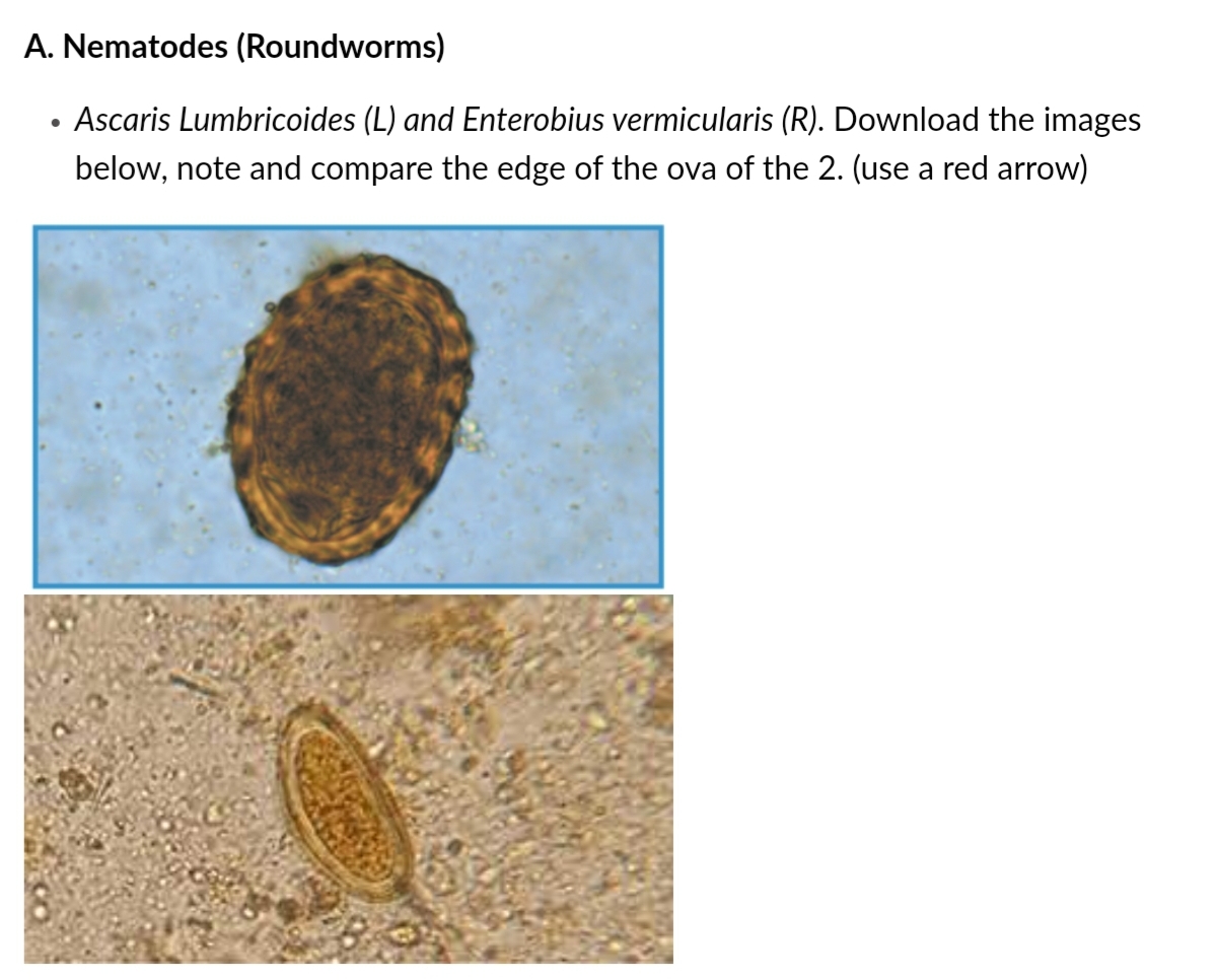 A. Nematodes (Roundworms)
Ascaris Lumbricoides (L) and Enterobius vermicularis (R). Download the images
below, note and compare the edge of the ova of the 2. (use a red arrow)
