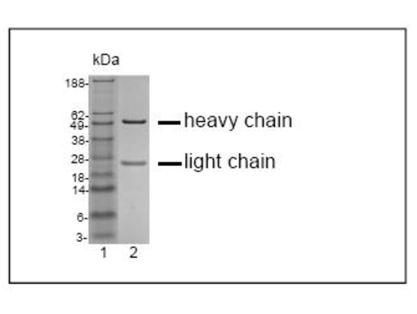 kDa
188-
-heavy chain
49-
38-
28-
18-
14-
-light chain
6-
3-
1 2
