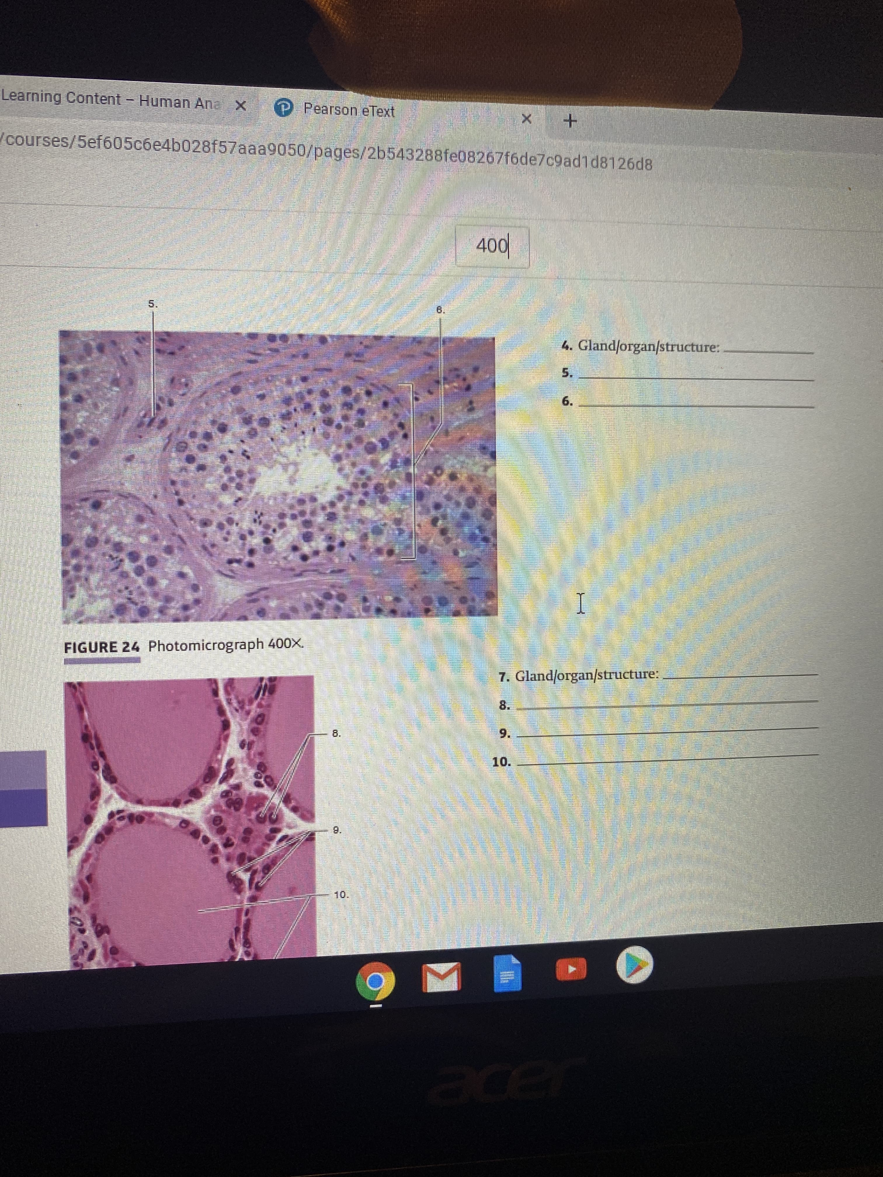 4. Gland/organ/structure:
5.
6.
