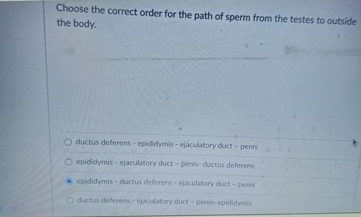 Choose the correct order for the path of sperm from the testes to outside
the body.
O ductus deferens - epididymis - ejaculatory duct - penis
O epididymis - ejaculatory duct - penis- ductus deferens
epididymis- ductus deferens- ejaculatory duct - penis
ductus deferens - ejaculatory duct-penis-epididymis.