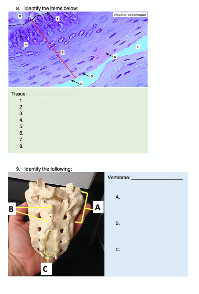 8. Identify the items below:
Tissue:
1.
2.
3.
4.
5.
6.
7.
8.
9. Identify the following:
B
COOP
A
Viscera: esophagus
Vertebrae:
A.
B.
C.