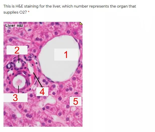 This is H&E staining for the liver, which number represents the organ that
supplies 02? *
Liver H&E
2
1
4
3
LO
