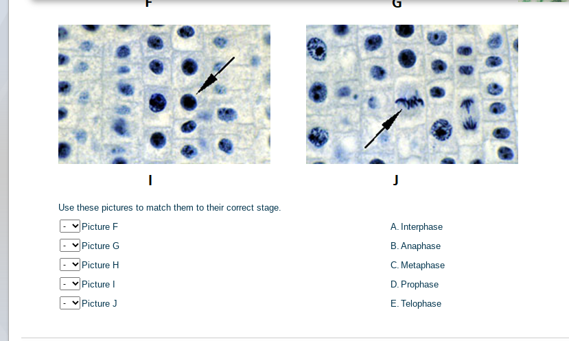 J
Use these pictures to match them to their correct stage.
Picture F
A. Interphase
Picture G
B. Anaphase
Picture H
C. Metaphase
Picture I
D. Prophase
vPicture J
E. Telophase
