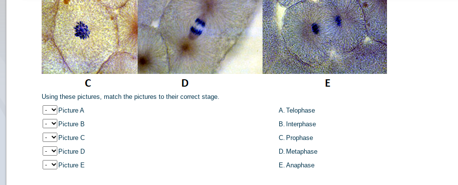 D
E
Using these pictures, match the pictures to their correct stage.
Picture A
A. Telophase
Picture B
B. Interphase
Picture C
C. Prophase
Picture D
D. Metaphase
Picture E
E. Anaphase
