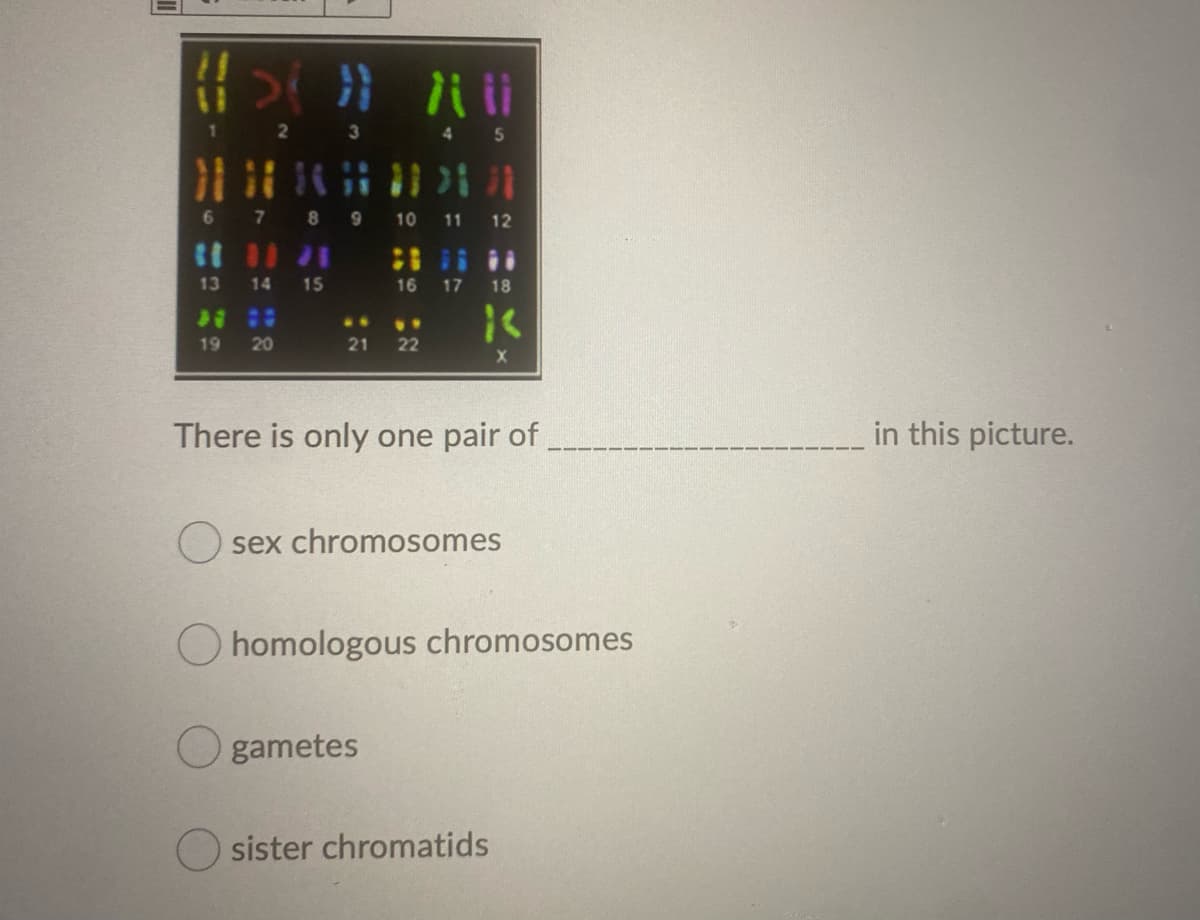 2
3 45
8 9
10
11
12
13
14
15
16
17
18
..
19
20
21
22
There is only one pair of
in this picture.
sex chromosomes
O homologous chromosomes
O gametes
O sister chromatids
