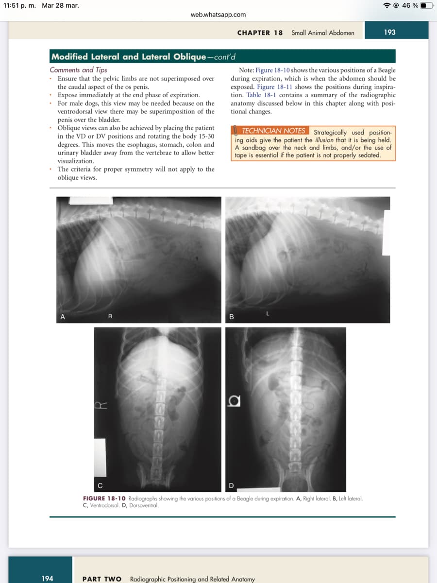 11:51 p. m. Mar 28 mar.
Modified Lateral and Lateral Oblique-cont'd
Comments and Tips
Ensure that the pelvic limbs are not superimposed over
the caudal aspect of the os penis.
Expose immediately at the end phase of expiration.
For male dogs, this view may be needed because on the
ventrodorsal view there may be superimposition of the
penis over the bladder.
web.whatsapp.com
• Oblique views can also be achieved by placing the patient
in the VD or DV positions and rotating the body 15-30
degrees. This moves the esophagus, stomach, colon and
urinary bladder away from the vertebrae to allow better
visualization.
194
The criteria for proper symmetry will not apply to the
oblique views.
R
CHAPTER 18 Small Animal Abdomen
Note: Figure 18-10 shows the various positions of a Beagle
during expiration, which is when the abdomen should be
exposed. Figure 18-11 shows the positions during inspira-
tion. Table 18-1 contains a summary of the radiographic
anatomy discussed below in this chapter along with posi-
tional changes.
B
TECHNICIAN NOTES Strategically used position-
ing aids give the patient the illusion that it is being held.
A sandbag over the neck and limbs, and/or the use of
tape is essential if the patient is not properly sedated.
193
D
C
FIGURE 18-10 Radiographs showing the various positions of a Beagle during expiration. A, Right lateral. B, Left lateral.
C, Ventrodorsal. D, Dorsoventral.
PART TWO Radiographic Positioning and Related Anatomy
46%