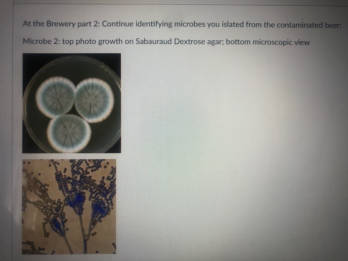 At the Brewery part 2: Continue identifying microbes you islated from the contaminated beer:
Microbe 2: top photo growth on Sabauraud Dextrose agar; bottom microscopic view

