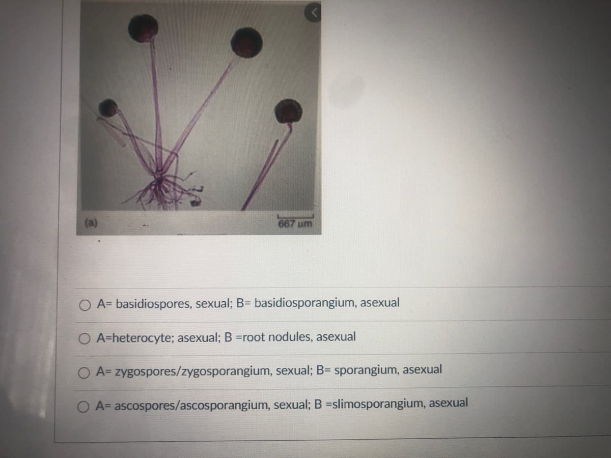 (a)
667 um
O A= basidiospores, sexual; B= basidiosporangium, asexual
O A=heterocyte; asexual; B =root nodules, asexual
A= zygospores/zygosporangium, sexual; B= sporangium, asexual
A= ascospores/ascosporangium, sexual; B =slimosporangium, asexual
