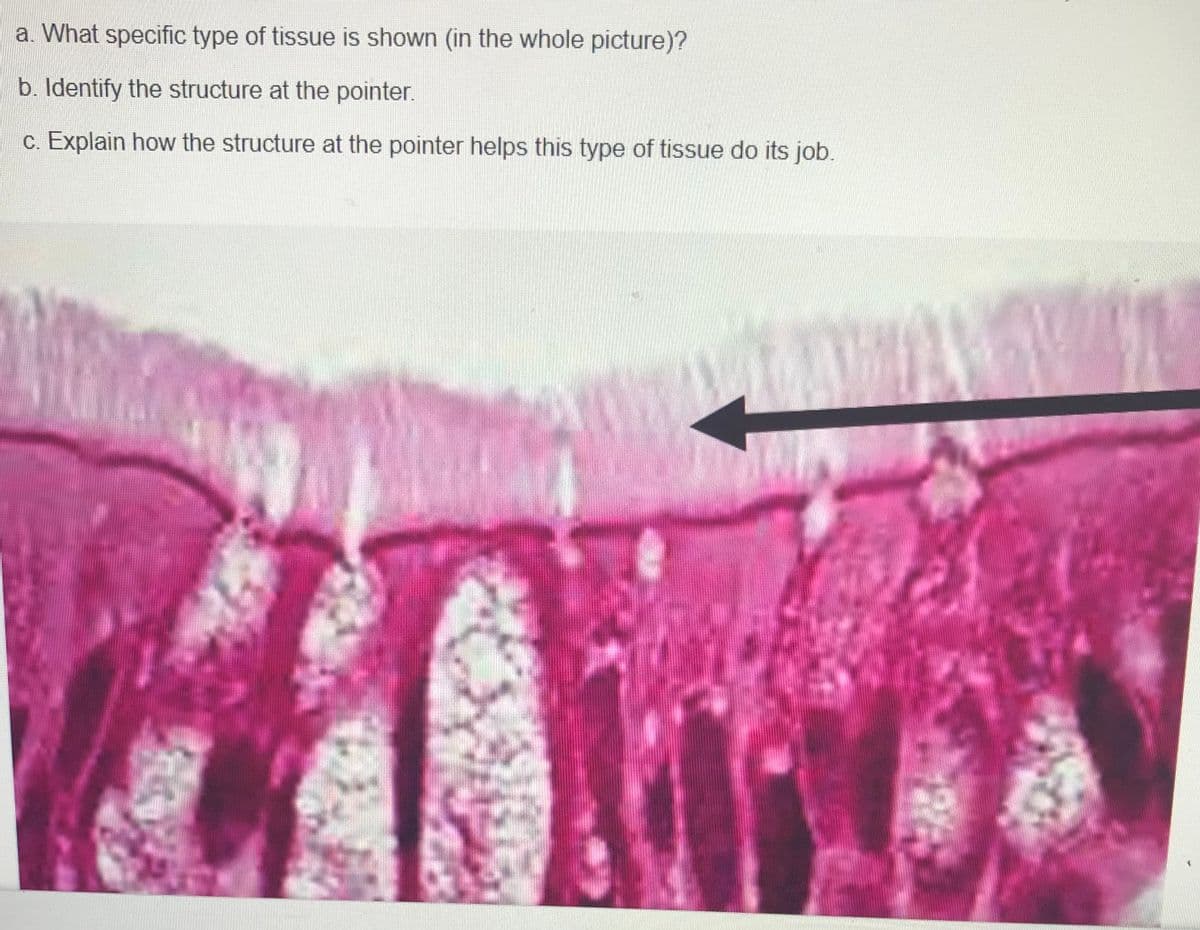 a. What specific type of tissue is shown (in the whole picture)?
b. Identify the structure at the pointer.
c. Explain how the structure at the pointer helps this type of tissue do its job.
