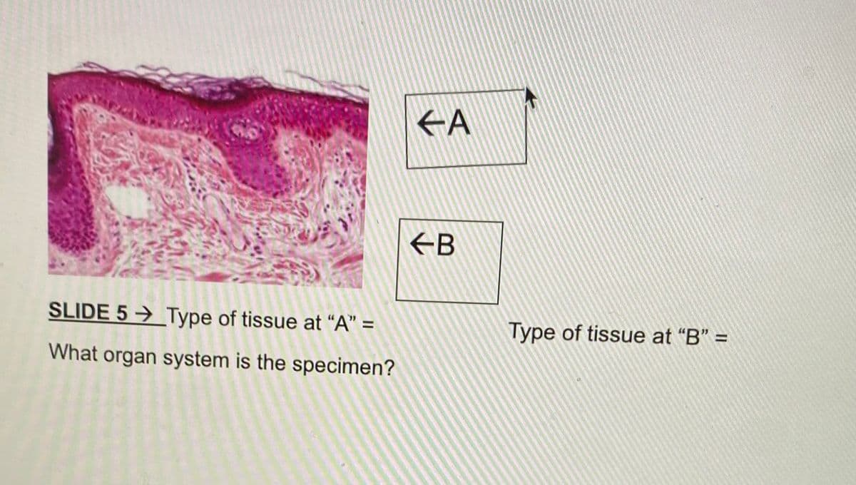 SLIDE 5 Type of tissue at "A" =
What organ system is the specimen?
FA
←B
Type of tissue at "B" =