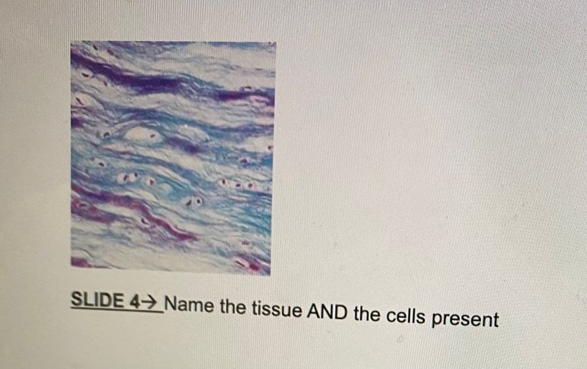 SLIDE 4→ Name the tissue AND the cells present