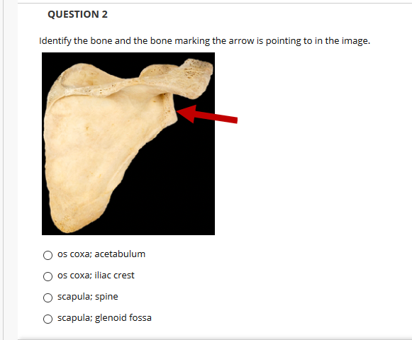 QUESTION 2
Identify the bone and the bone marking the arrow is pointing to in the image.
os coxa; acetabulum
os coxa; iliac crest
O scapula; spine
O scapula; glenoid fossa
