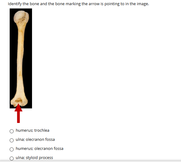 Identify the bone and the bone marking the arrow is pointing to in the image.
humerus; trochlea
O ulna; olecranon fossa
humerus; olecranon fossa
O ulna; styloid process
