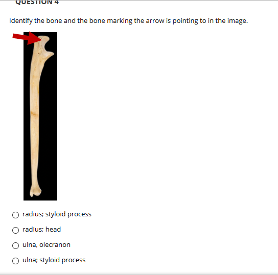 QUESTION
Identify the bone and the bone marking the arrow is pointing to in the image.
O radius; styloid process
O radius; head
O ulna, olecranon
O ulna; styloid process
