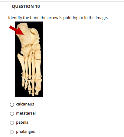 QUESTION 10
Identify the bone the arrow is pointing to in the image.
calcaneus
metatarsal
O patella
O phalanges
