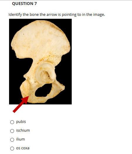 QUESTION 7
Identify the bone the arrow is pointing to in the image.
O pubis
ischium
ilium
OS Coxa
