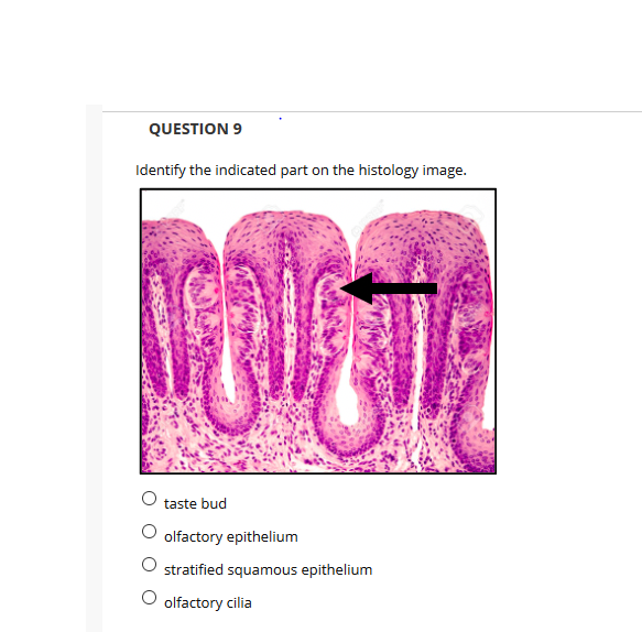 QUESTION 9
Identify the indicated part on the histology image.
taste bud
olfactory epithelium
stratified squamous epithelium
olfactory cilia
