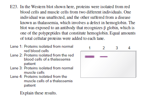 E23. In the Western blot shown here, proteins were isolated from red
blood cells and muscle cells from two different individuals. One
individual was unaffected, and the other suffered from a disease
known as thalassemia, which involves a defect in hemoglobin. The
blot was exposed to an antibody that recognizes B globin, which is
one of the polypeptides that constitute hemoglobin. Equal amounts
of total cellular proteins were added to each lane.
Lane 1: Proteins isolated from normal
2
3
4
red blood cells
Lane 2: Proteins isolated from the red
blood cells of a thalassemia
patient
Lane 3: Proteins isolated from normal
muscle cells
Lane 4: Proteins isolated from the
muscle cells of a thalassemia
patient
Explain these results.
