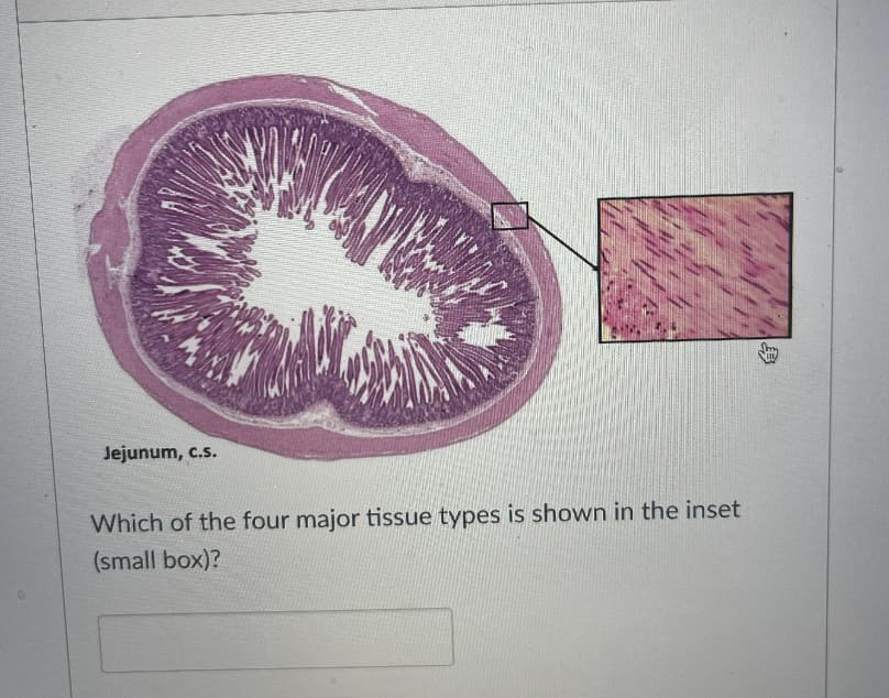 Jejunum, c.s.
Which of the four major tissue types is shown in the inset
(small box)?
