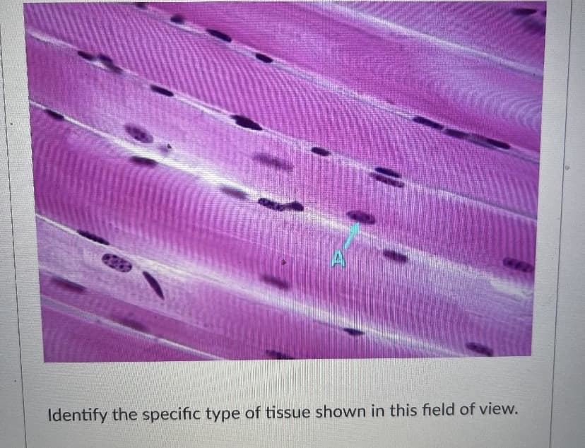 Identify the specific type of tissue shown in this field of view.
