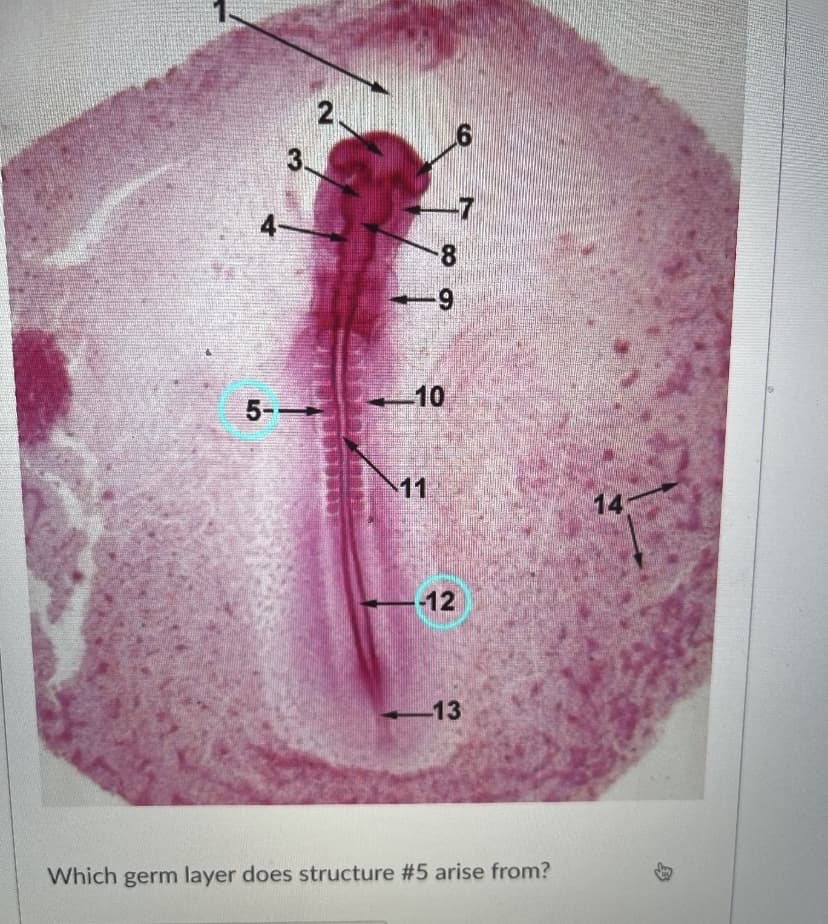 191
3.
8-
6-
-10
5-
11
14
-12
-13
Which germ layer does structure #5 arise from?
身
