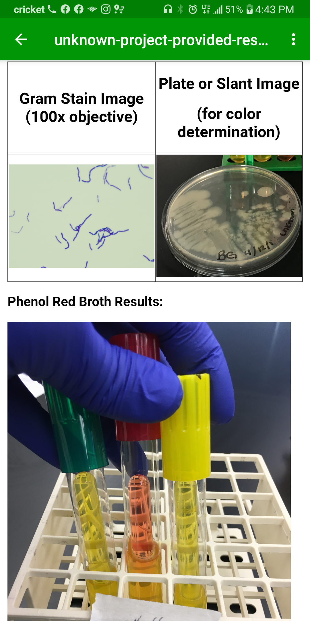 cricket
El 51%
4:43 PM
unknown-project-provided-res..
Plate or Slant Image
Gram Stain Image
(100x objective)
(for color
determination)
BG 4/211
Phenol Red Broth Results:
