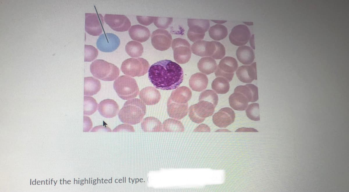 Identify the highlighted cell type.
