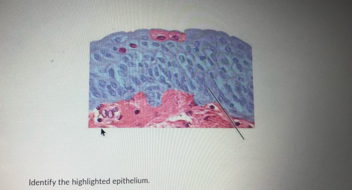 Identify the highlighted epithelium.
