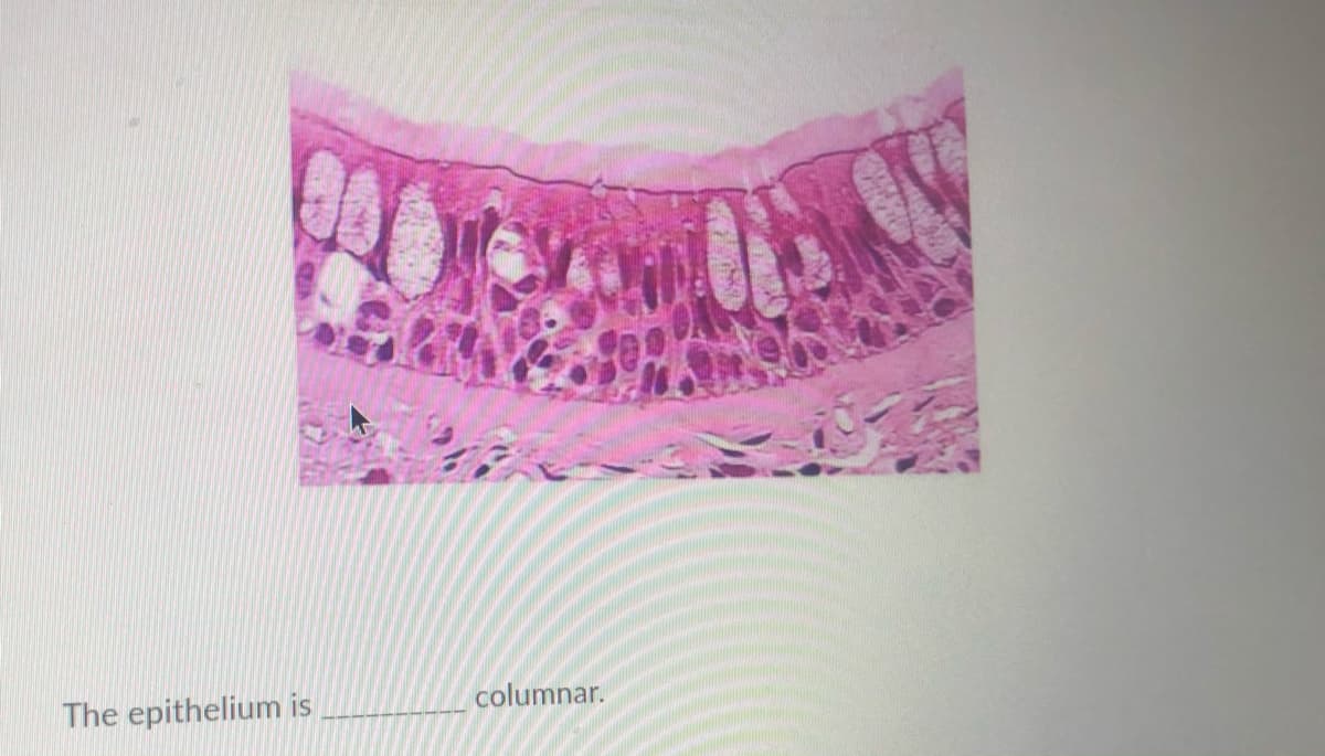 The epithelium is
columnar.
