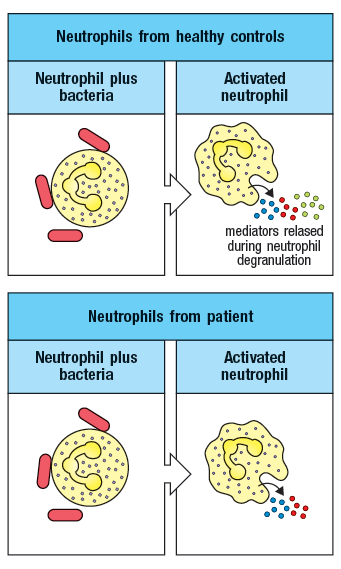 Neutrophils from healthy controls
Neutrophil plus
bacteria
Activated
neutrophil
mediators relased
during neutrophil
degranulation
Neutrophils from patient
Neutrophil plus
bacteria
Activated
neutrophil
