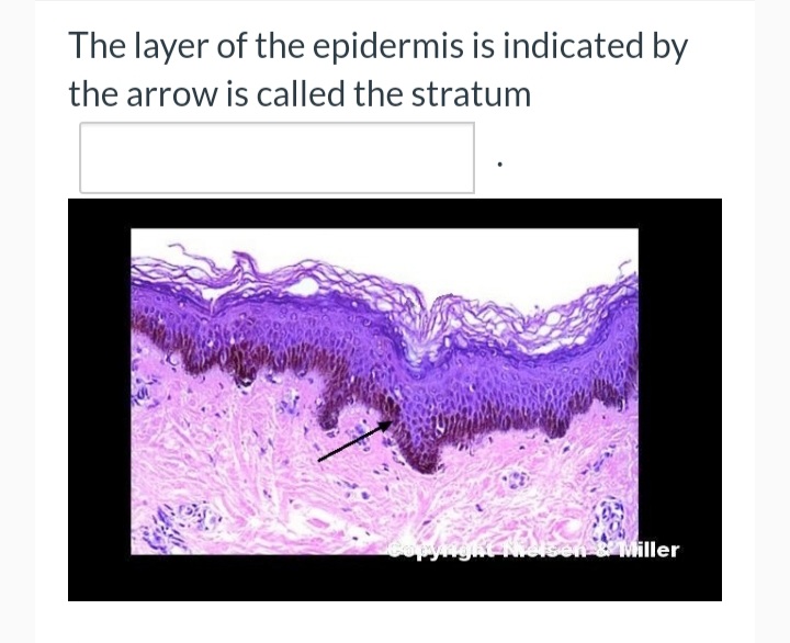The layer of the epidermis is indicated by
the arrow is called the stratum
e Miller
