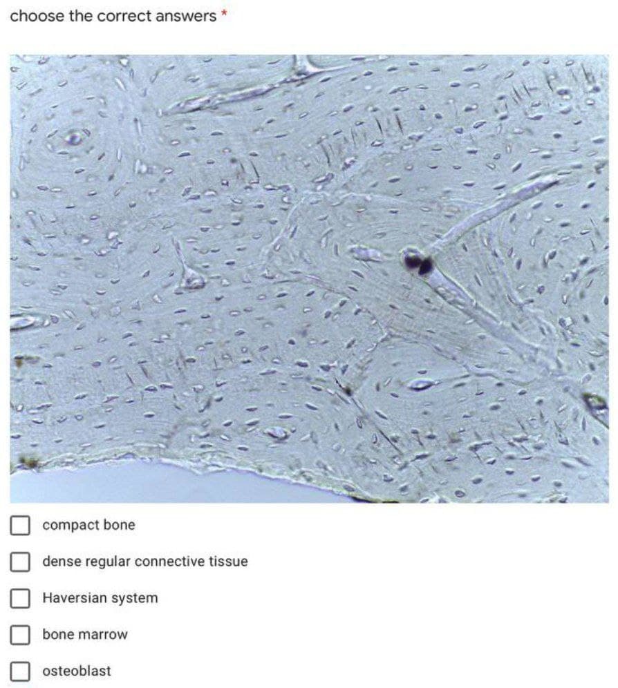 choose the correct answers *
compact bone
dense regular connective tissue
Haversian system
bone marrow
osteoblast
