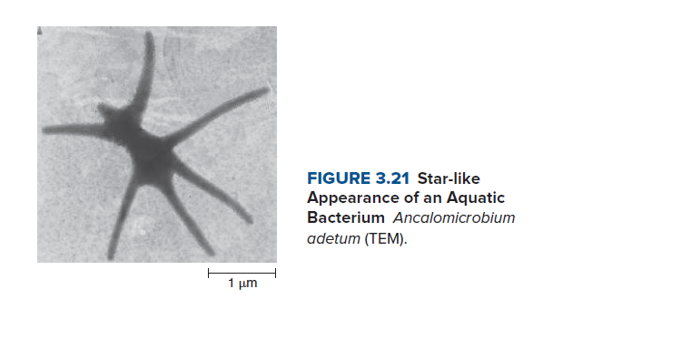 FIGURE 3.21 Star-like
Appearance of an Aquatic
Bacterium Ancalomicrobium
adetum (TEM).
1 µm
