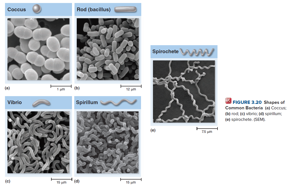 Coccus
Rod (bacillus)
Spirochete
(a)
1 μη
(b)
12 um
Vibrio
Spirillum
O FIGURE 3.20 Shapes of
Common Bacteria (a) Coccus;
(b) rod; (c) vibrio; (d) spirillum;
(e) spirochete. (SEM).
(e)
7.5 µm
(c)
15 μη
(d)
15 μη
