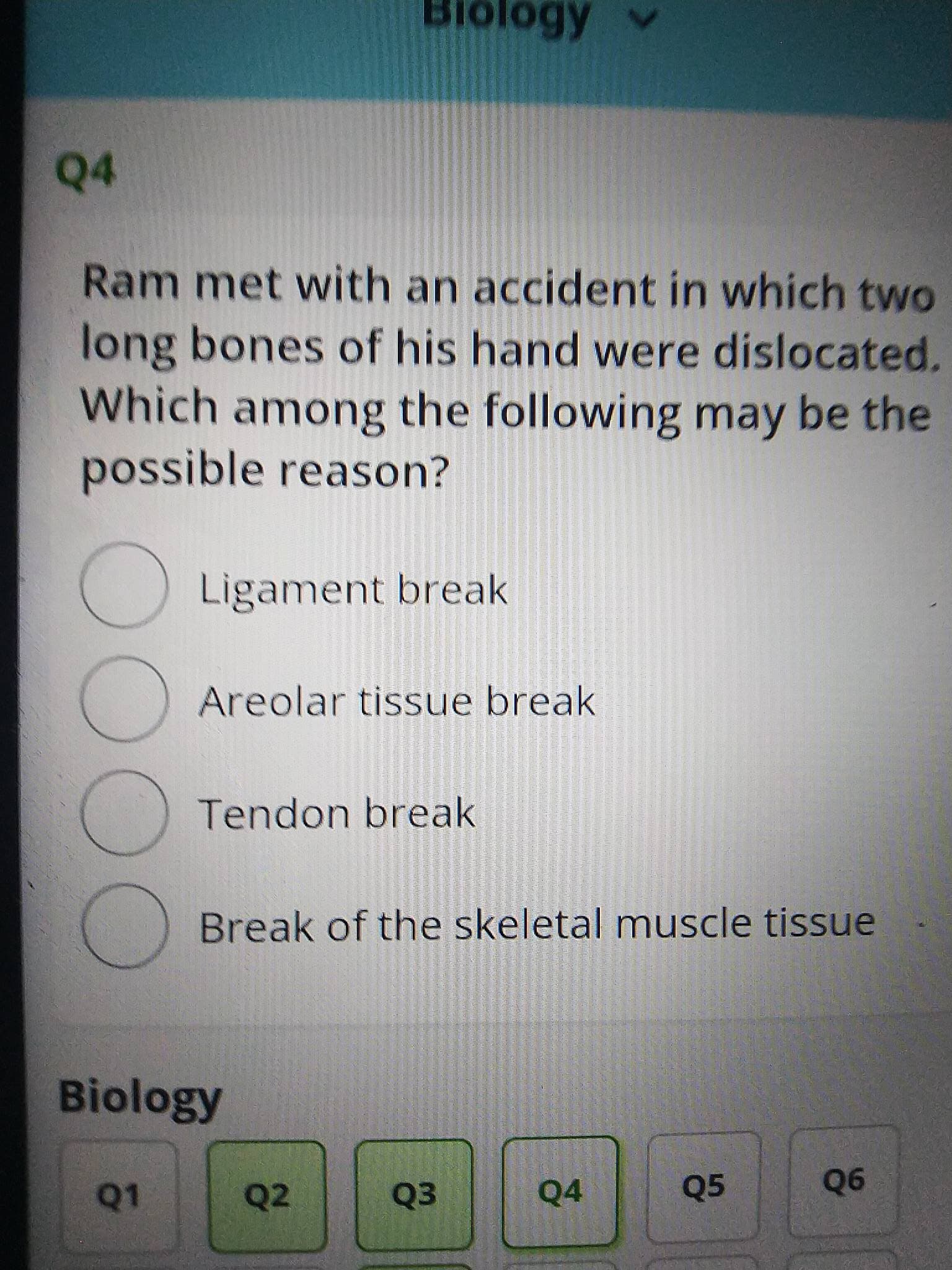 99
0OO
10
Q4
Ram met with an accident in which two
long bones of his hand were dislocated.
Which among the following may be the
possible reason?
Ligament break
Areolar tissue break
Tendon break
Break of the skeletal muscle tissue
Biology
Q2
Q3
Q4
Q5

