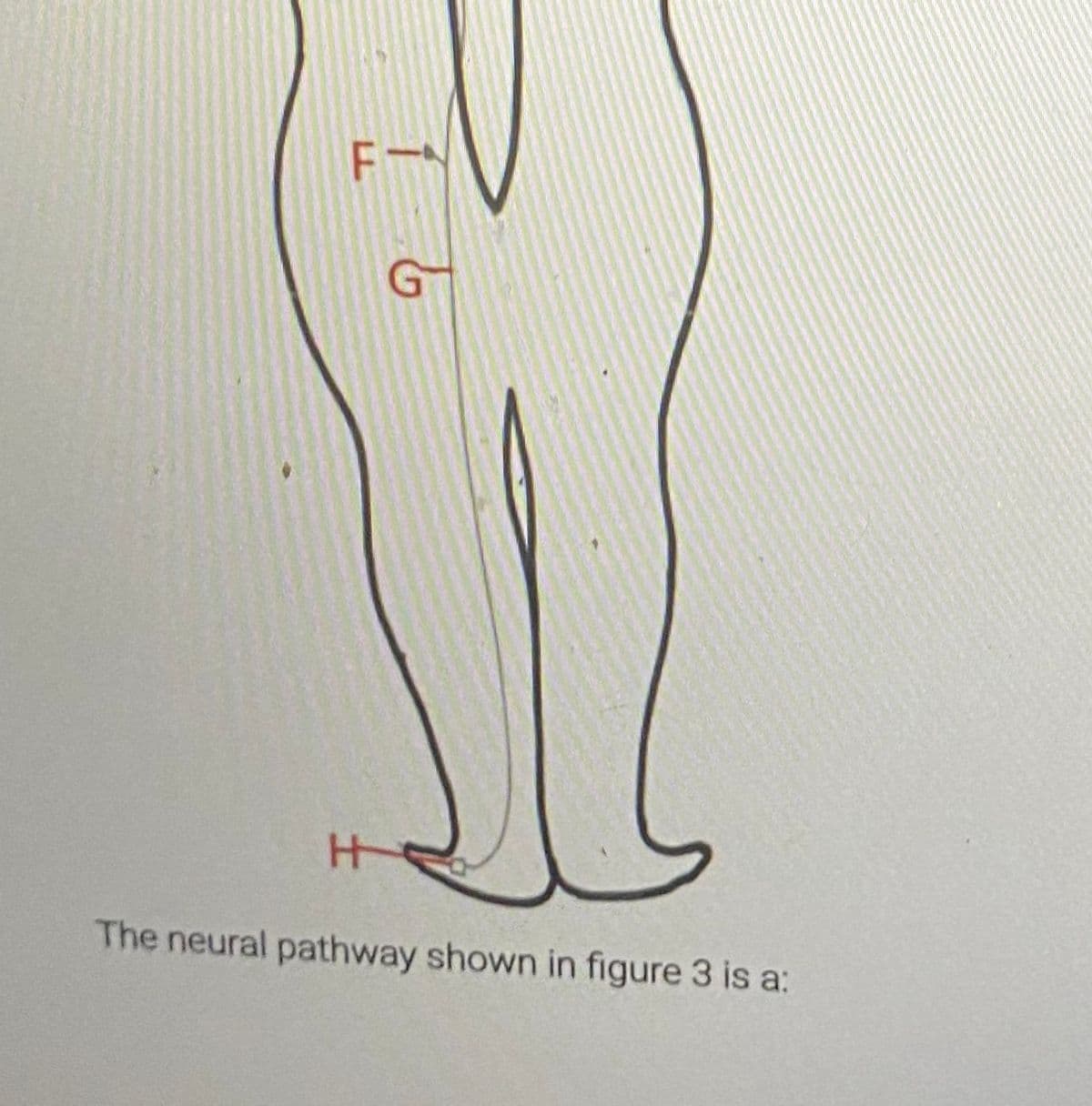 F-
The neural pathway shown in figure 3 is a:
