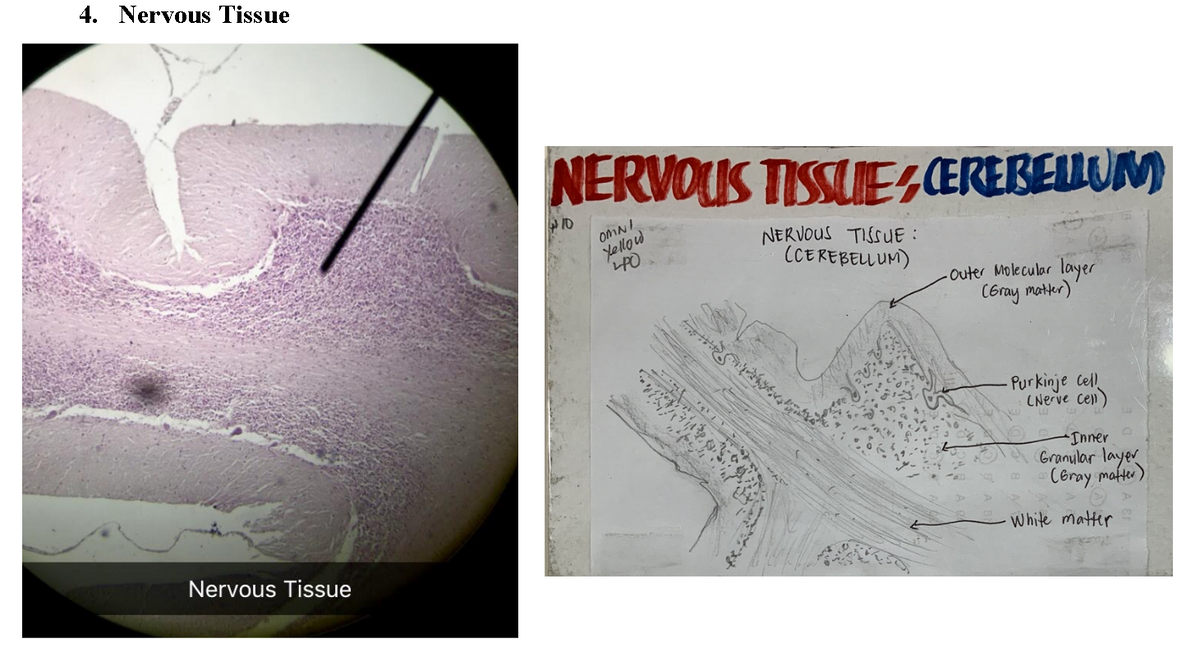 4. Nervous Tissue
NERVOUS TISSIE,ÆREBEUUM
OMNI
NERVOUS TISSUE :
(CEREBELLUM)
Xellow
-outer Molecular layer
CGray matker)
-Purkinje cel
CNerve cen)
Inner
Granular layer
Ceray mater)
White matter
Nervous Tissue
