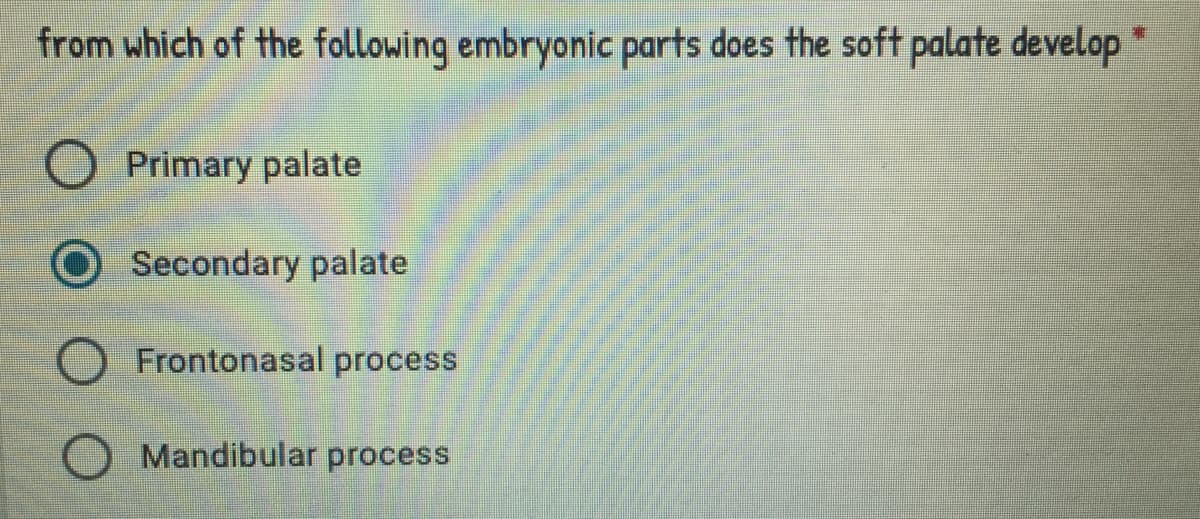 from which of the following embryonic parts does the soft palate develop
O Primary palate
O Secondary palate
O Frontonasal process
Mandibular process
