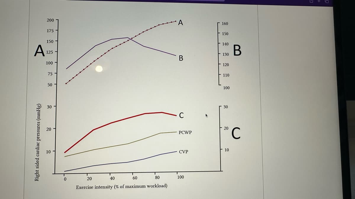 A
Right sided cardiac pressures (mmHg)
200
175
150
125
100
75
50
30
20
2
10-
0
20
40
60
80
Exercise intensity (% of maximum workload)
A
B
C
PCWP
CVP
100
160
- 150
140
130
120
110
100
30
20
10
B
C
+10