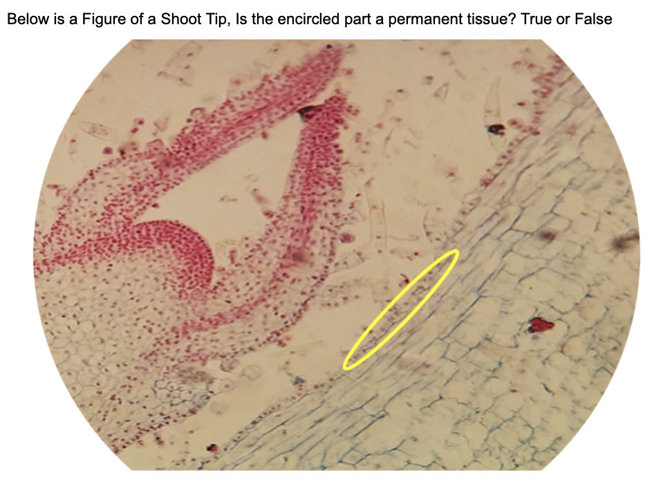 Below is a Figure of a Shoot Tip, Is the encircled part a permanent tissue? True or False