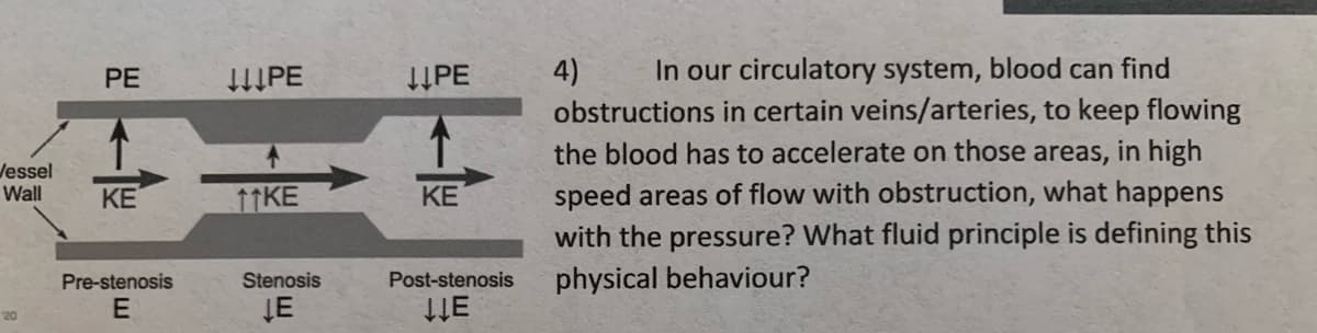 In our circulatory system, blood can find
4)
obstructions in certain veins/arteries, to keep flowing
PE
HIPE
IPE
the blood has to accelerate on those areas, in high
Jessel
Wall
speed areas of flow with obstruction, what happens
with the pressure? What fluid principle is defining this
physical behaviour?
KE
11KE
KE
Pre-stenosis
Stenosis
Post-stenosis
ĮE
20
