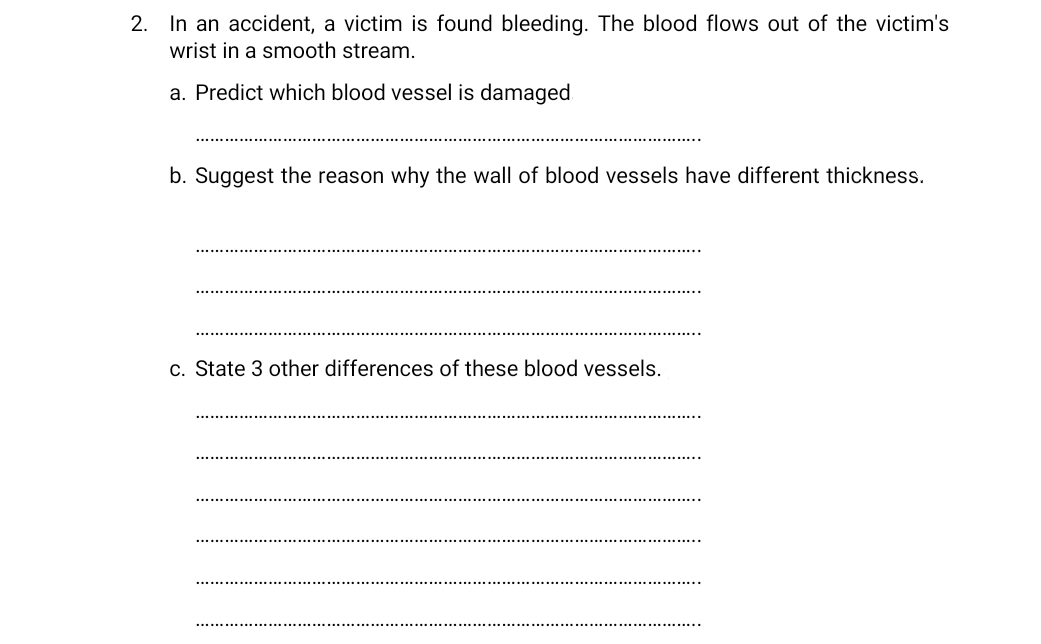 2. In an accident, a victim is found bleeding. The blood flows out of the victim's
wrist in a smooth stream.
a. Predict which blood vessel is damaged
b. Suggest the reason why the wall of blood vessels have different thickness.
c. State 3 other differences of these blood vessels.
