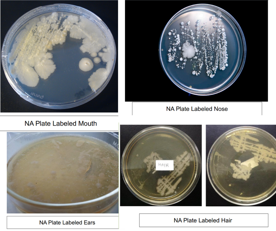 greiner
NA Plate Labeled Nose
NA Plate Labeled Mouth
MO
HAIR
NA Plate Labeled Hair
NA Plate Labeled Ears
