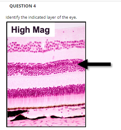 QUESTION 4
Identify the indicated layer of the eye.
High Mag
