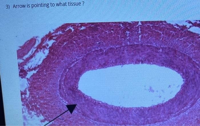 3) Arrow is pointing to what tissue?