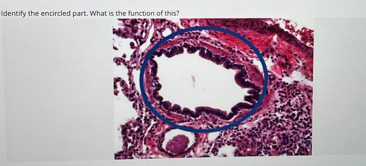 Identify the encircled part. What is the function of this?