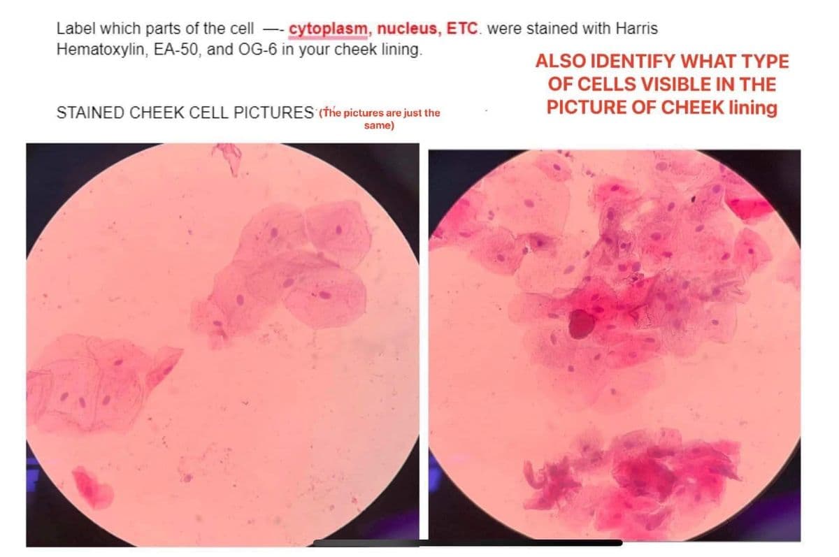 Label which parts of the cell cytoplasm, nucleus, ETC. were stained with Harris
Hematoxylin, EA-50, and OG-6 in your cheek lining.
STAINED CHEEK CELL PICTURES (the pictures are just the
same)
ALSO IDENTIFY WHAT TYPE
OF CELLS VISIBLE IN THE
PICTURE OF CHEEK lining