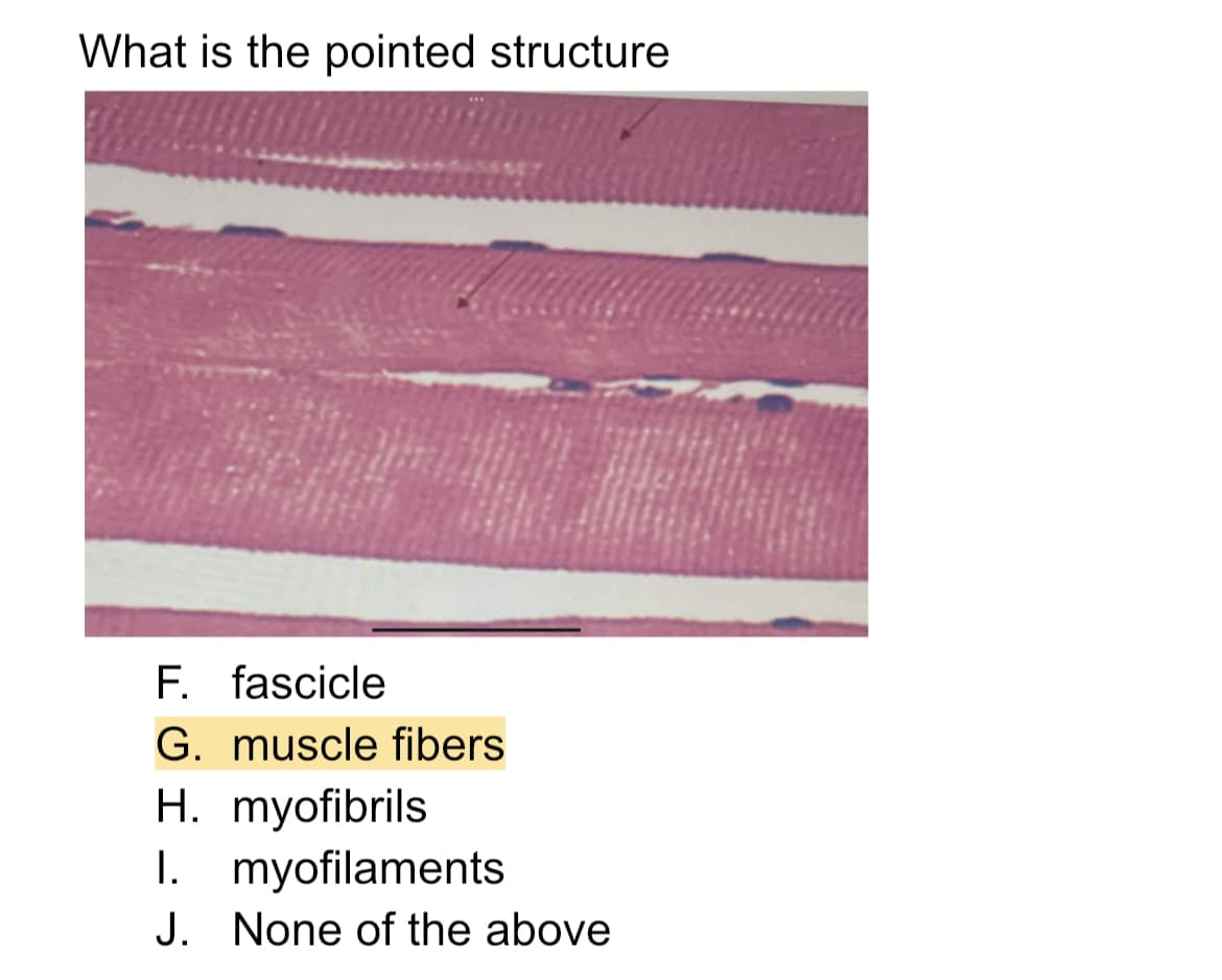 What is the pointed structure
F. fascicle
G. muscle fibers
H. myofibrils
I. myofilaments
J. None of the above